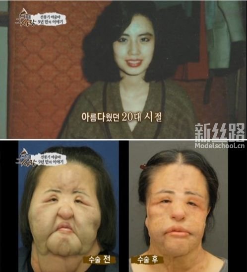 美女模特整容变成“电风扇大妈”
